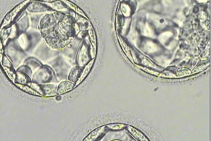 De acordo com jornais australianos, o bebê nasceu em 2024. A idade da criança e as identidades dos pacientes envolvidos não foram reveladas -  (crédito: Unidade de fertilização in vitro Shaare Zedek)