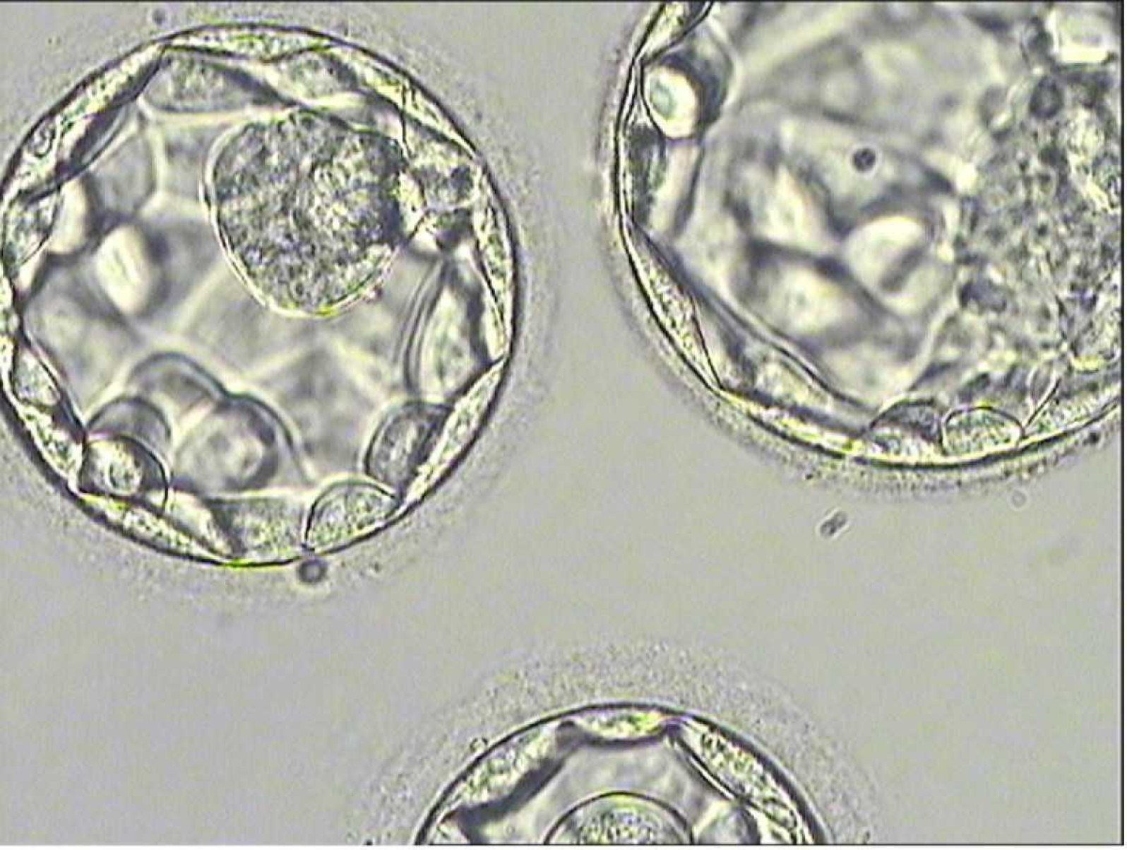 Mulher tem bebê de outra pessoa após clínica de fertilização cometer erro Mulher tem bebê de outra pessoa após clínica de fertilização cometer erro