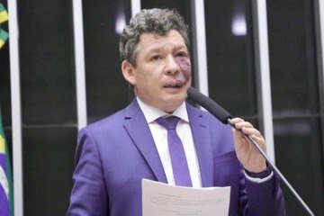 'Isso aí é uma minoria da minoria, dentro do bolsonarismo radicalizado, de extrema-direita, que não são propositivos e não contribuem com o desenvolvimento do país', afirmou o deputado -  (crédito: Divulgação/Câmara dos Deputados)