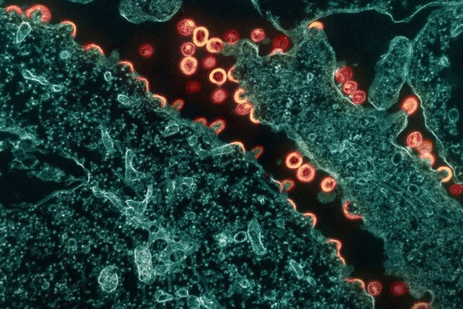 Micrografia eletrônica de transmissão de partículas do vírus HIV-1 (rosa/castanho) brotando e replicando de um segmento de uma célula H9 cronicamente infectada (azul-petróleo)
 -  (crédito: NIAID)