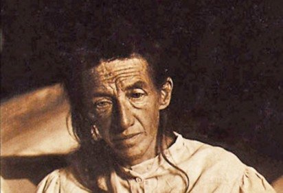 A primeira pessoa diagnosticada com o Mal de Alzheimer foi Auguste Deter, alemã que morrreu em 8/4/1906, aos 55 anos. Nascida em Kassel, em 16/5/1850, ela entrou para a história por causa da enfermidade. Auguste adoeceu em 1901, aos 50 anos, e ficou internada o restante da vida.  -  (crédito: Domínio público )