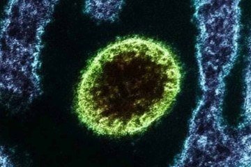 O vírus pode ser transmitido de animais para seres humanos, além de circular em alimentos contaminados e diretamente entre pessoas - (crédito: Divulgação/Instituto Nacional de Alergia e Doenças Infecciosas dos EUA) O vírus pode ser transmitido de animais para seres humanos, além de circular em alimentos contaminados e diretamente entre pessoas - (crédito: Divulgação/Instituto Nacional de Alergia e Doenças Infecciosas dos EUA)