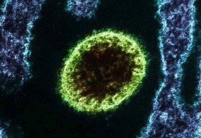 O vírus pode ser transmitido de animais para seres humanos, além de circular em alimentos contaminados e diretamente entre pessoas -  (crédito: Divulgação/Instituto Nacional de Alergia e Doenças Infecciosas dos EUA) -O vírus pode ser transmitido de animais para seres humanos, além de circular em alimentos contaminados e diretamente entre pessoas -  (crédito: Divulgação/Instituto Nacional de Alergia e Doenças Infecciosas dos EUA)