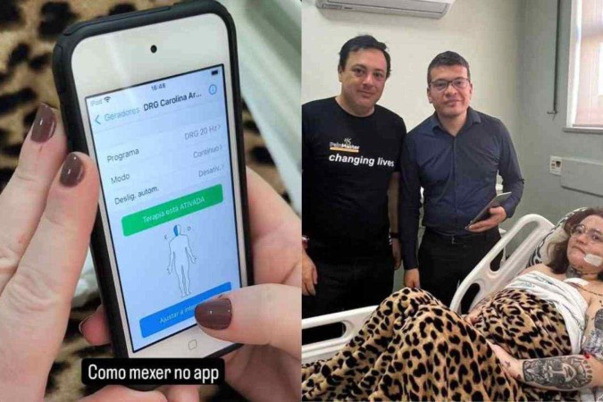 Carolina Arruda realizou cirurgia para implantar neuroestimuladores que podem ser controlados pela própria paciente em momentos de crise -  (crédito: Redes sociais/Reprodução)