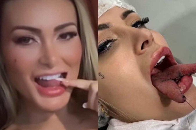 Andressa Urach -  (crédito: Redes Sociais )