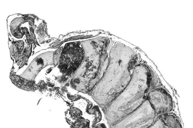 Os cientistas conseguiram identificar partes específicas da anatomia da criatura, incluindo seu trato digestivo (acima, à direita) e seu cérebro (abaixo, à direita) -  (crédito: Martin R Smith/Emma J Long)