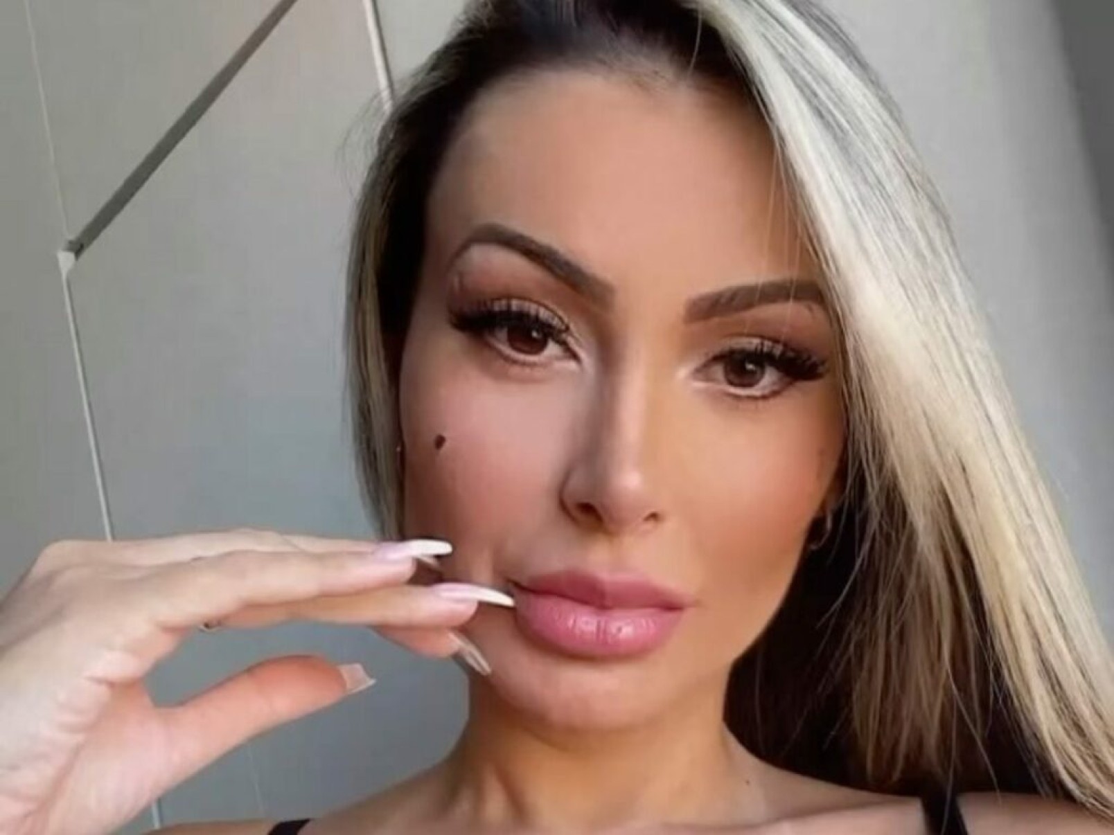 Andressa Urach detalha processo de recuperação: 