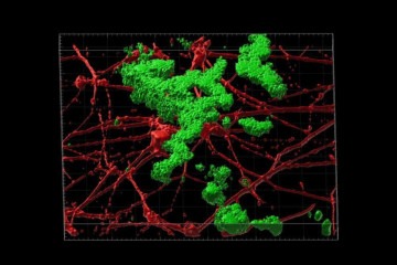 Reconstrução em 3D da deposição de placa beta amiloide (verde) entre neurônios (vermelhos) cultivados artificialmente -  (crédito: ANDREW YOO e ZHAO SUN/Universidade de Washington)