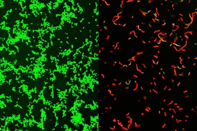 Micróbios saudáveis (verde à esquerda) e, após o tratamento, bactérias mortas (vermelho à direita) -  (crédito: Zongsen Zou, Ph.D, Universidade de Washington em St Louis)