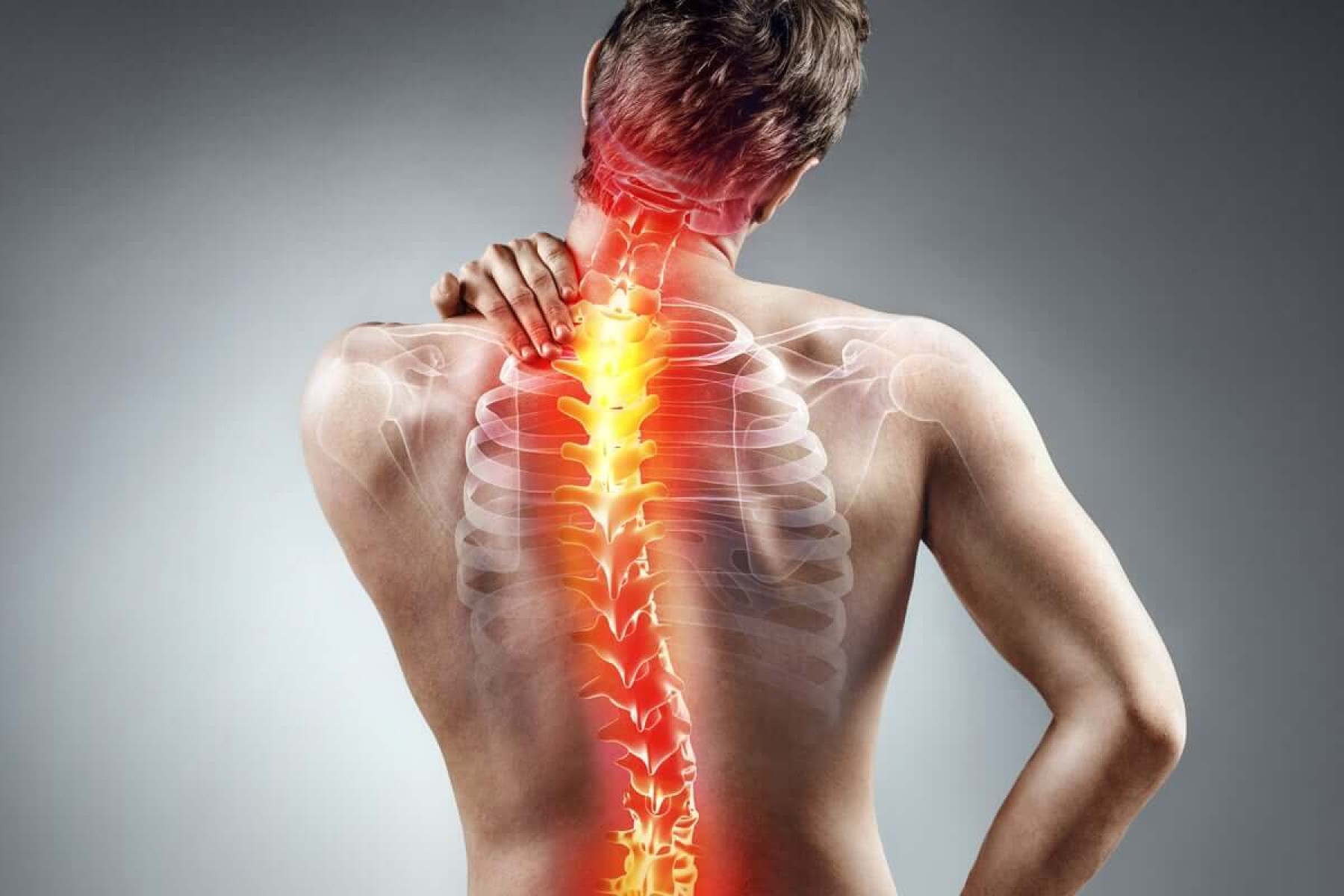 A escoliose é a curvatura anormal da coluna vertebral, mas pode ser detectada e tratada precocemente para evitar complicações (Imagem: RomarioIen| Shutterstock) -  (crédito: EdiCase)