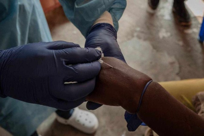 Mpox não é 'nova covid' e pode ser contida, diz especialista da OMS -  (crédito: BBC)