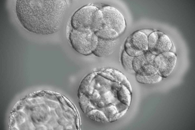 Diferentes fases do desenvolvimento embrionário humano