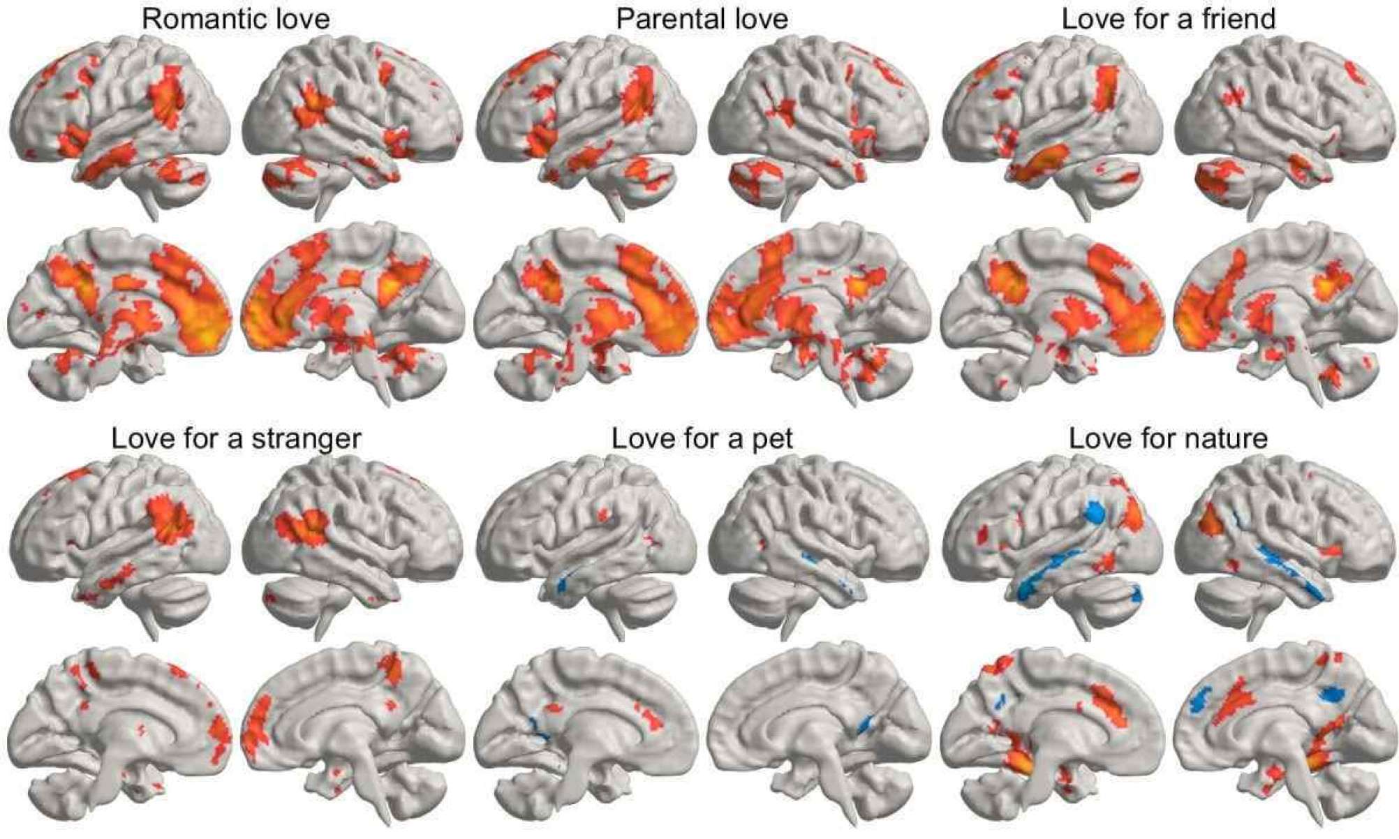 Cerebral manifestation in the face of every kind of love