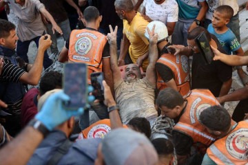 Equipes de resgate carregam um homem ferido em um ataque aéreo israelense contra uma escola no bairro de Zeitoun, na Cidade de Gaza 