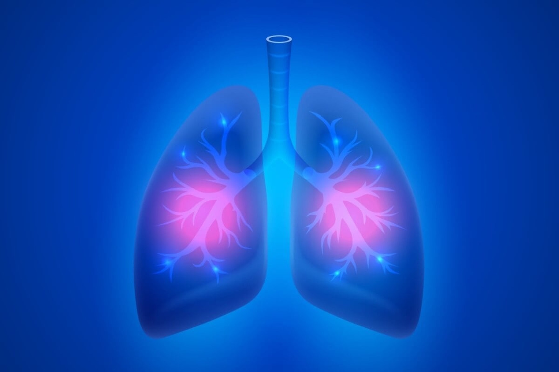 A pneumonia é uma doença causada por bactérias, fungos ou vírus que afetam o pulmão (Imagem: HobbitArt | Shutterstock) -  (crédito: EdiCase)