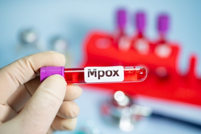 A mpox é uma doença viral transmitida por contato direto com lesões ou superfícies contaminadas (Imagem: QINQIE99 | Shutterstock) -  (crédito: EdiCase)