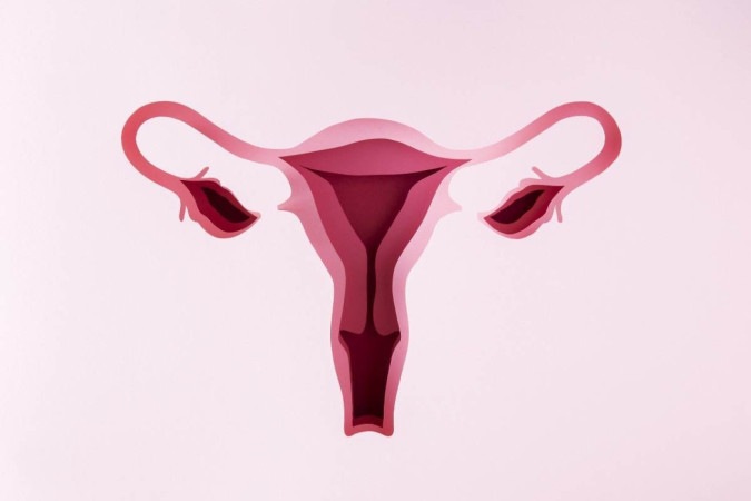 A hidrossalpinge é uma doença caracterizada pelo acúmulo de líquido nas tubas uterinas. -  (crédito: Freepik)