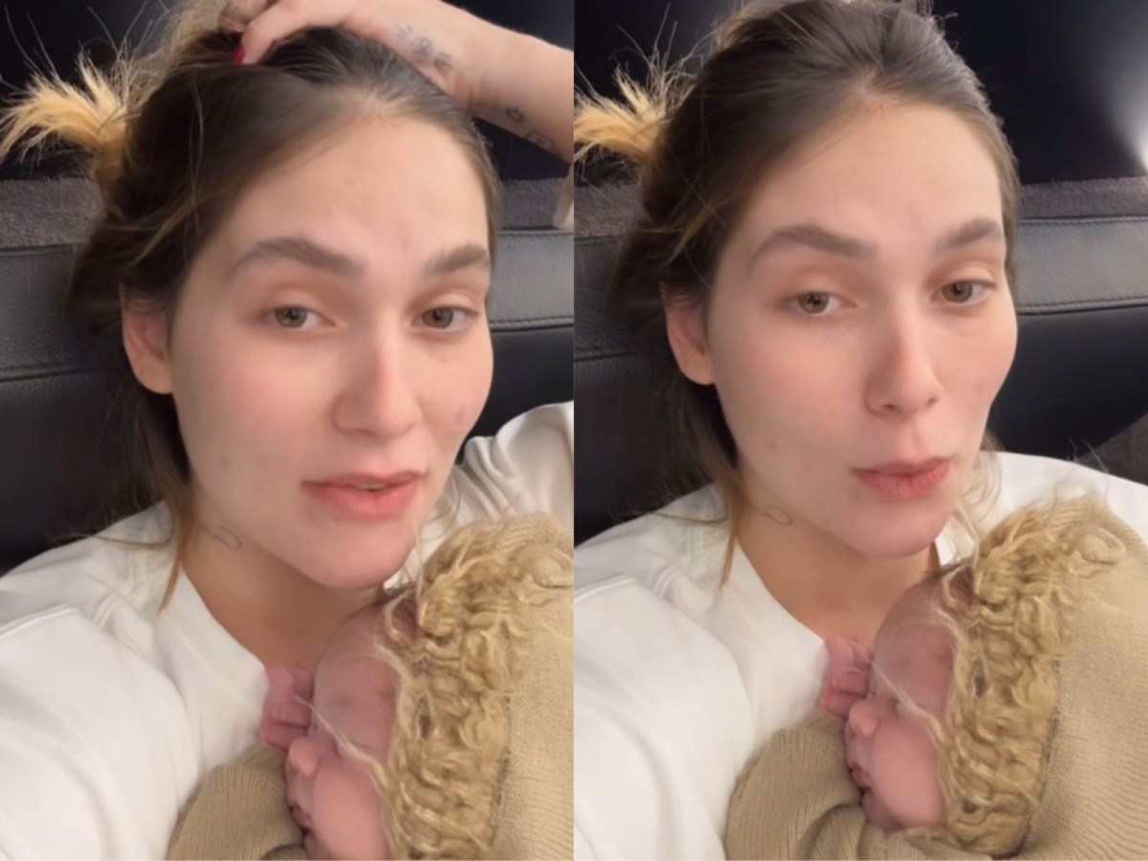 Virgínia revela problemas com cesariana no pós-parto