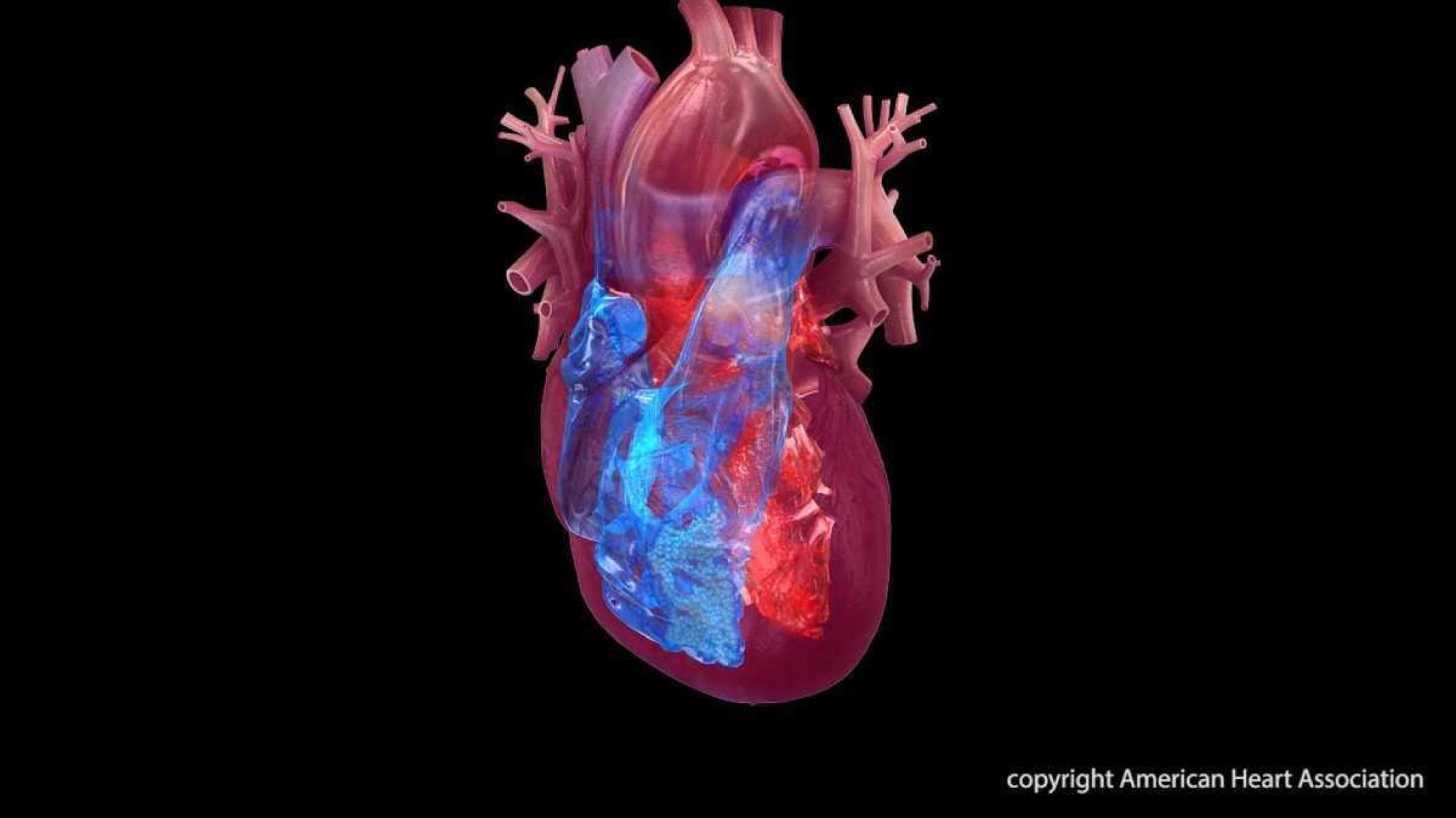 Doenças cardiovasculares estão relacionadas com maiores riscos de demência