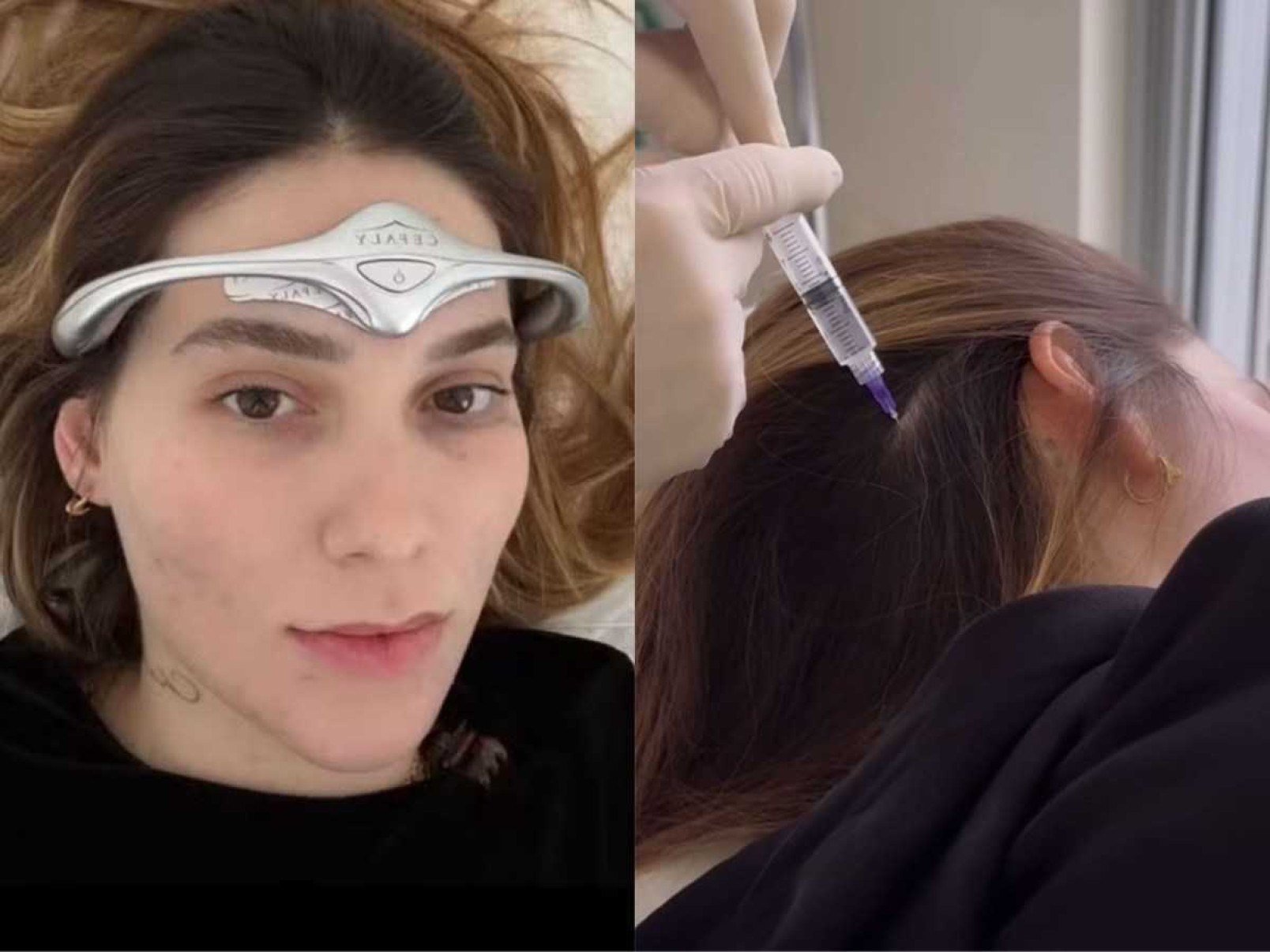 Virginia Fonseca mostra bastidores de tratamento para dores de cabeça