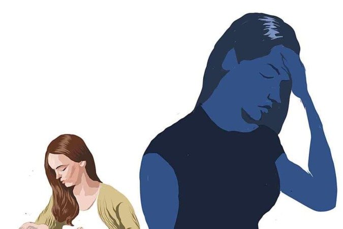 A depressão pós-parto costuma se iniciar algumas semanas após o parto