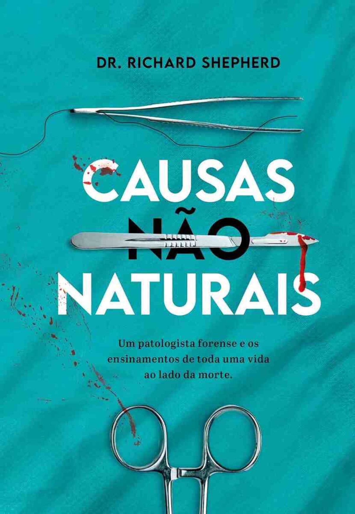 Causas não naturais