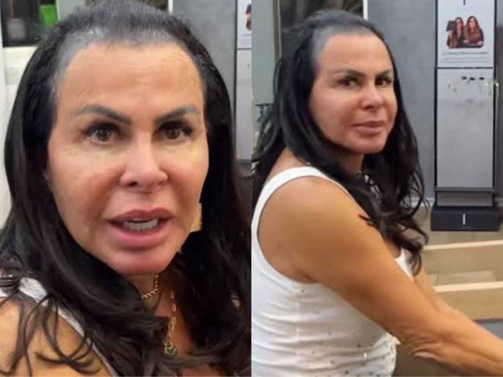 Gretchen se irrita com críticas e explica problema no cabelo: 
