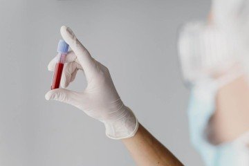 exame de sangue -  (crédito: Freepik)