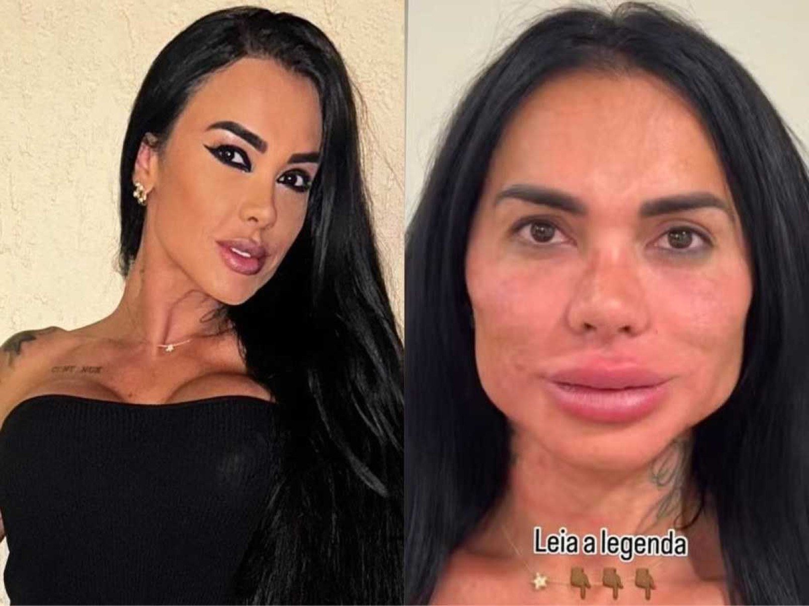 Kamila Simioni é detonada na web ao mostrar resultado de harmonização facial