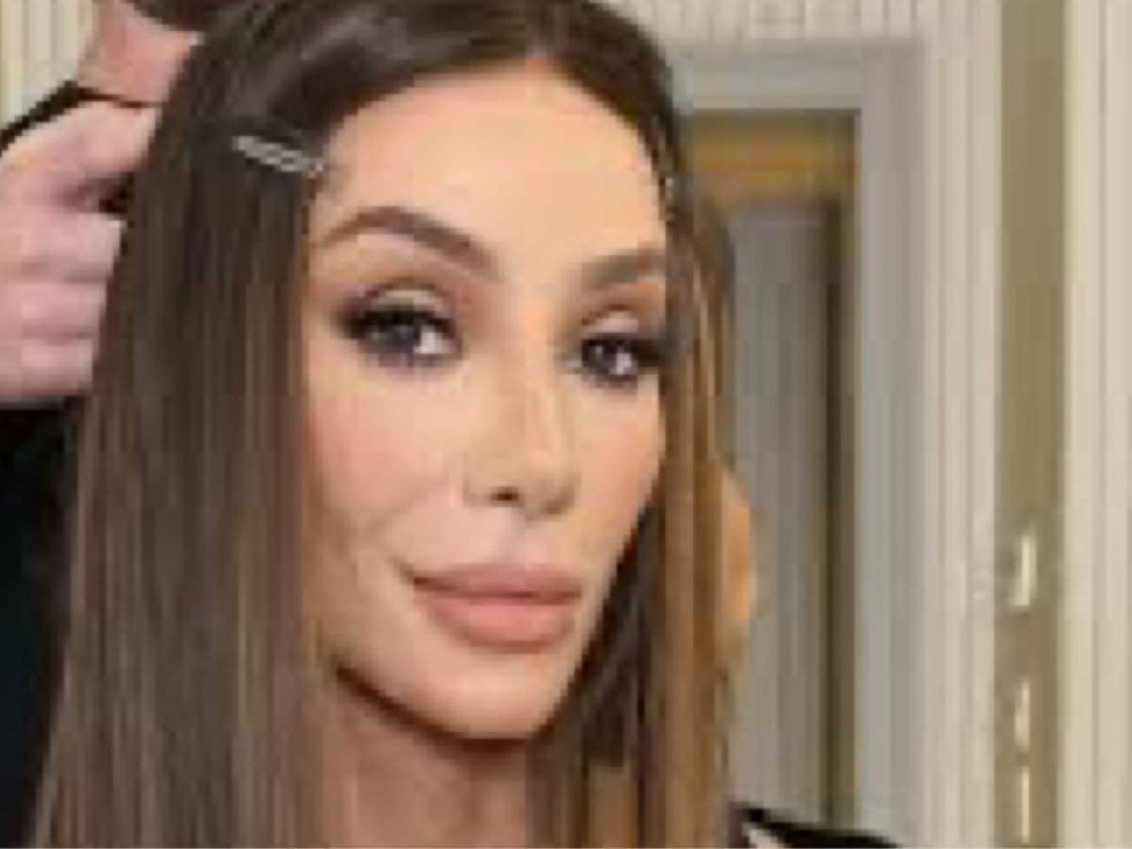 Maya Massafera passa por nova cirurgia para correção de 