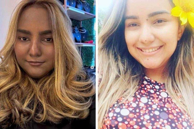 Sabrina teve alterações na cor de pele devido à Síndrome de Cushing e a um tumor raro no tórax -  (crédito: Reprodução / Instagram)