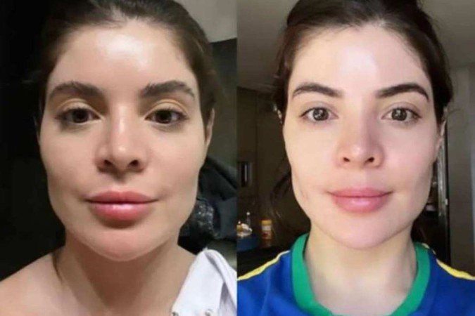 A influenciadora Gkay retirou seu preenchimento labial com a justificativa de ter exagerado demais ao longo dos anos 