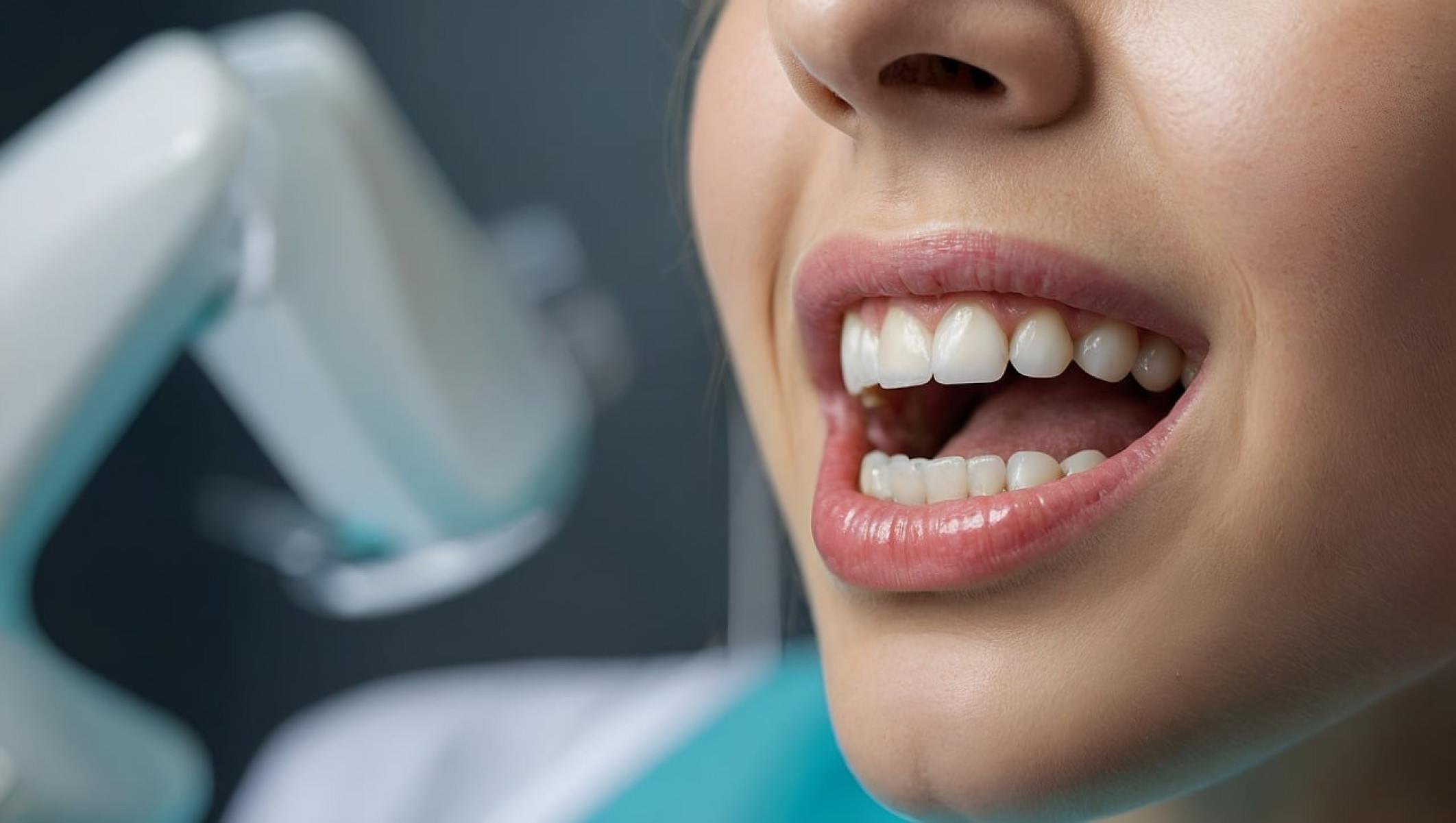 Clareamento dental com PAP reduz a sensibilidade e irritação -  (crédito: DINO)