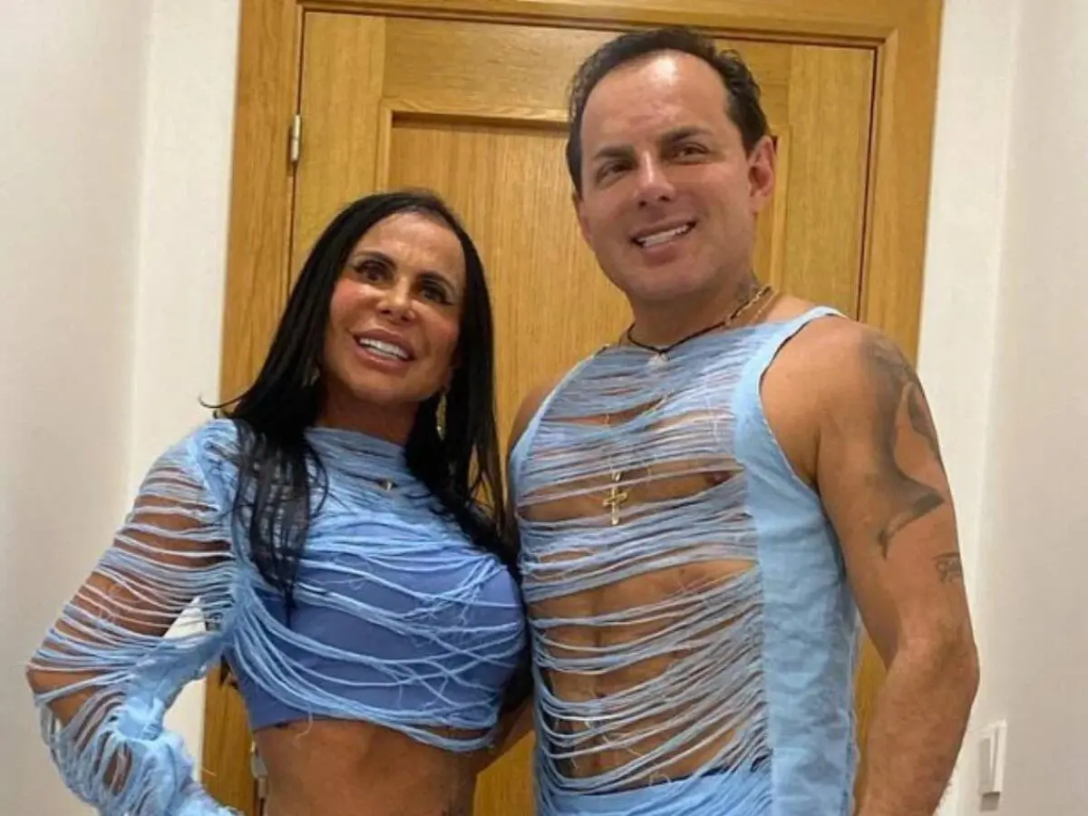 Marido de Gretchen impressiona com antes e depois de procedimentos no rosto -  (crédito: Observatorio dos Famosos)