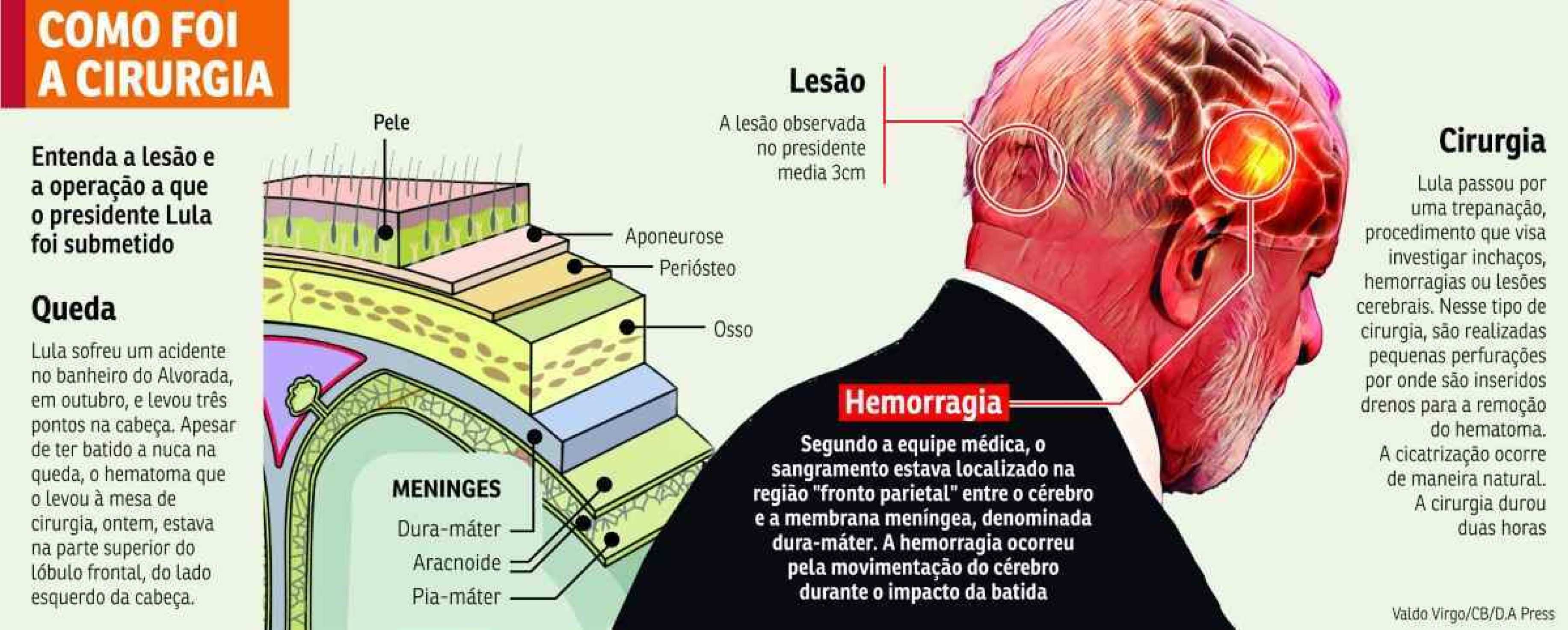 Lula Cirurgia