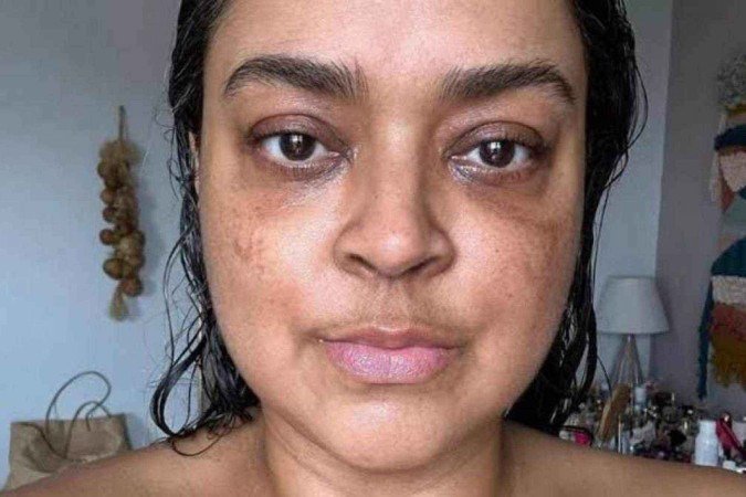 Preta Gil fala sobre nova cirurgia - (crédito: Reprodução Instagram ) Preta Gil fala sobre nova cirurgia - (crédito: Reprodução Instagram )