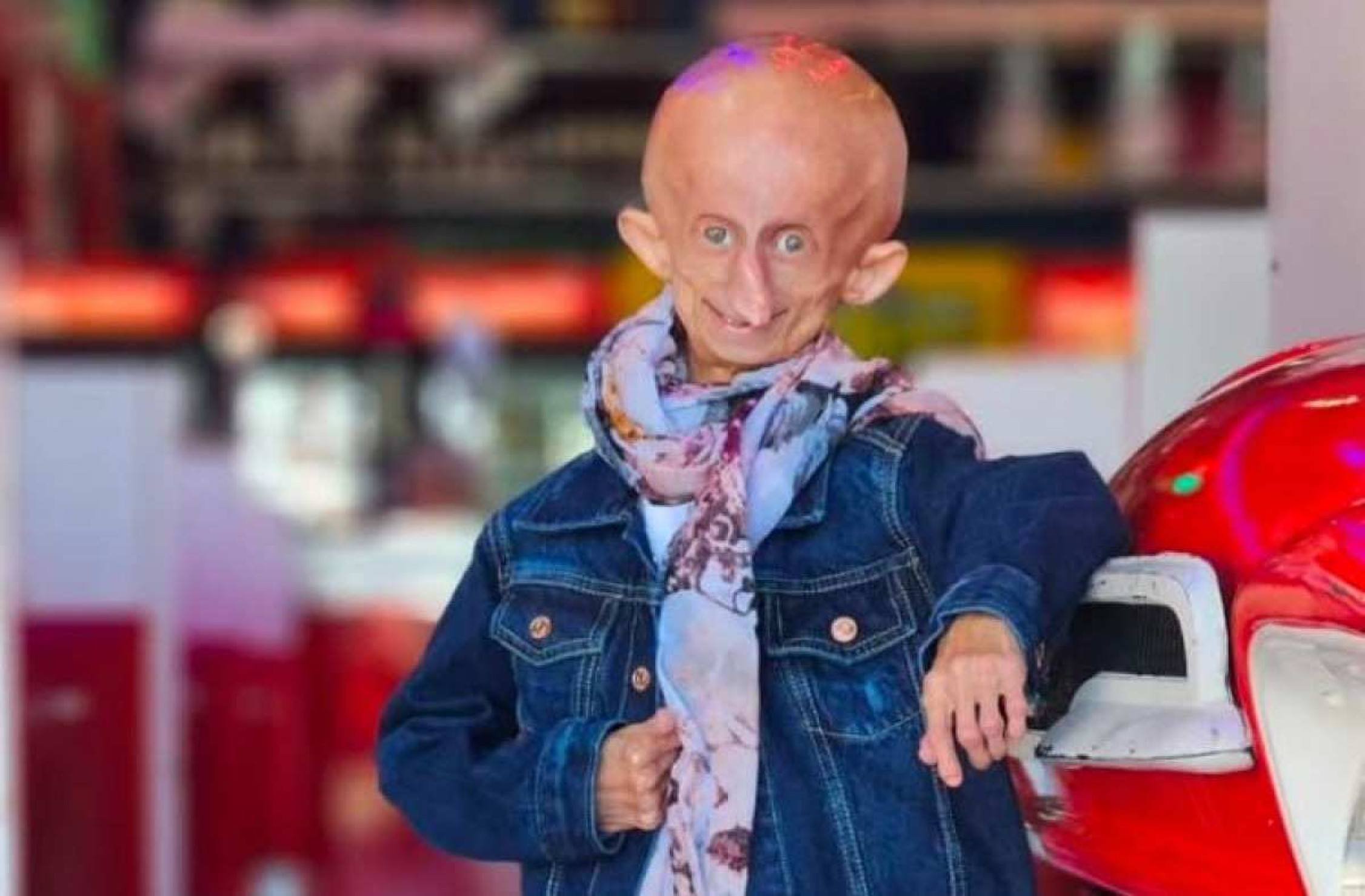 Influenciadora do TikTok portadora de condição rara morre aos 19 anos 