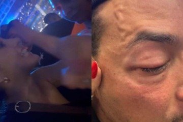 Felipe Franco acusa seguranças do show de Chris Brown de agressão