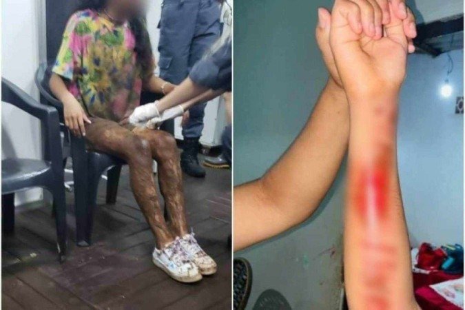 Uma das crianças chegou a ficar presa debaixo do vagão e foi arrastada por alguns metros - (crédito: Arquivo pessoal) Uma das crianças chegou a ficar presa debaixo do vagão e foi arrastada por alguns metros - (crédito: Arquivo pessoal)