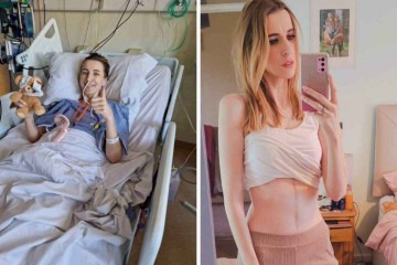 Louise durante recuperação e após o tratamento -  (crédito: Instagram)