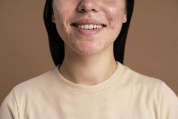 Mulheres têm mais probabilidade de um tratamento secundário - (crédito: Image by Freepik) Mulheres têm mais probabilidade de um tratamento secundário - (crédito: Image by Freepik)