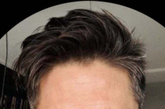  Eixo Capital. Procurador da RepÃºblica Fernando Rocha