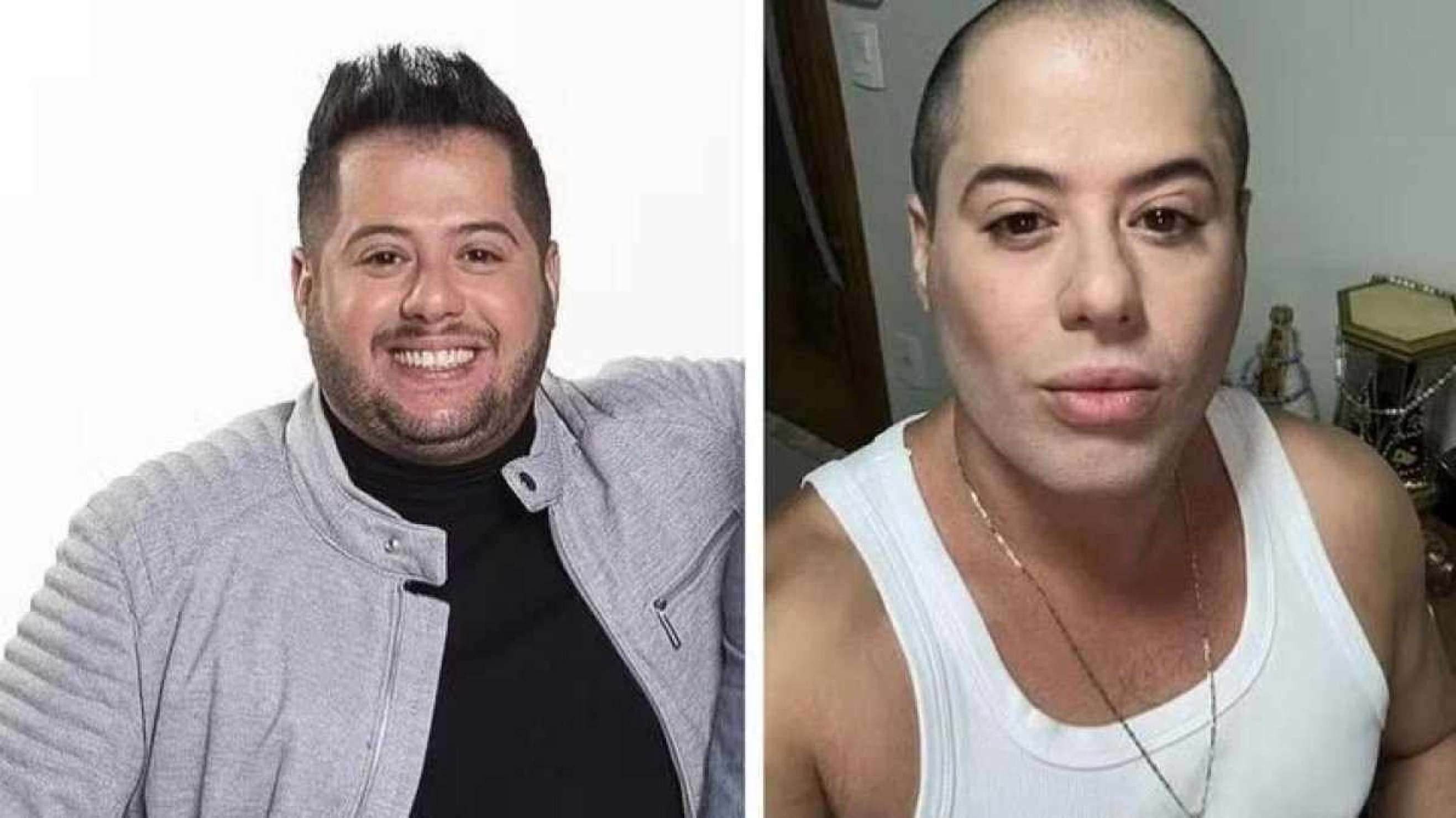 Sertanejo Hugo faz mudança radical na aparência e web reage: 'Gretchen?