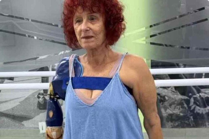 Escritora Roseana Murray começou a usar uma prótese nesta sexta-feira (25/1). Ela perdeu o braço após um ataque de pitbulls 