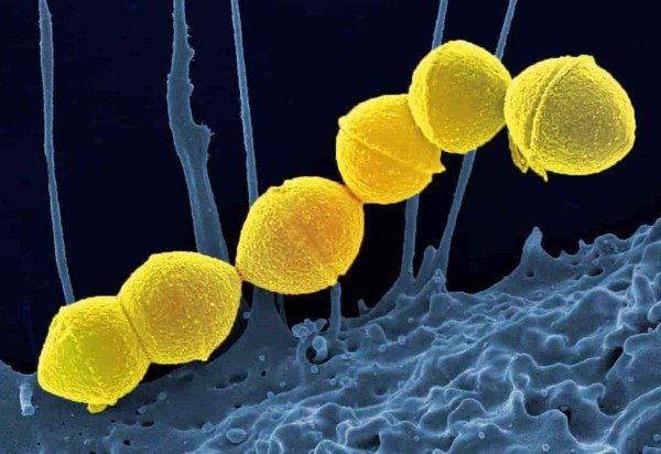 National Institute of Allergy and Infectious Diseases, NIH