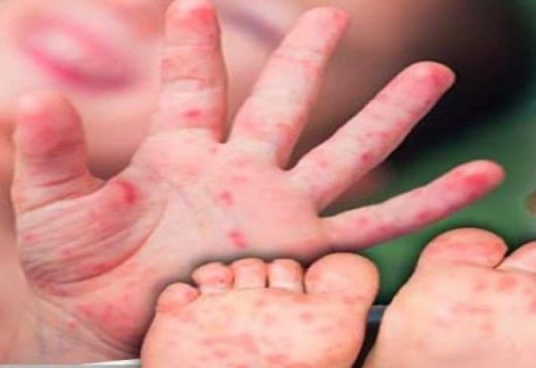 Reprodução/ Pinterest