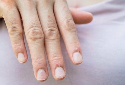 O que as unhas revelam sobre a sua saúde -  (crédito: Getty Images)