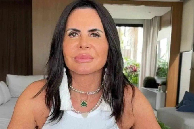 A melhora significativa no quadro levou a artista a cancelar um transplante capilar que estava agendado para março de 2025 - (crédito: Reprodução / Internet) A melhora significativa no quadro levou a artista a cancelar um transplante capilar que estava agendado para março de 2025 - (crédito: Reprodução / Internet)