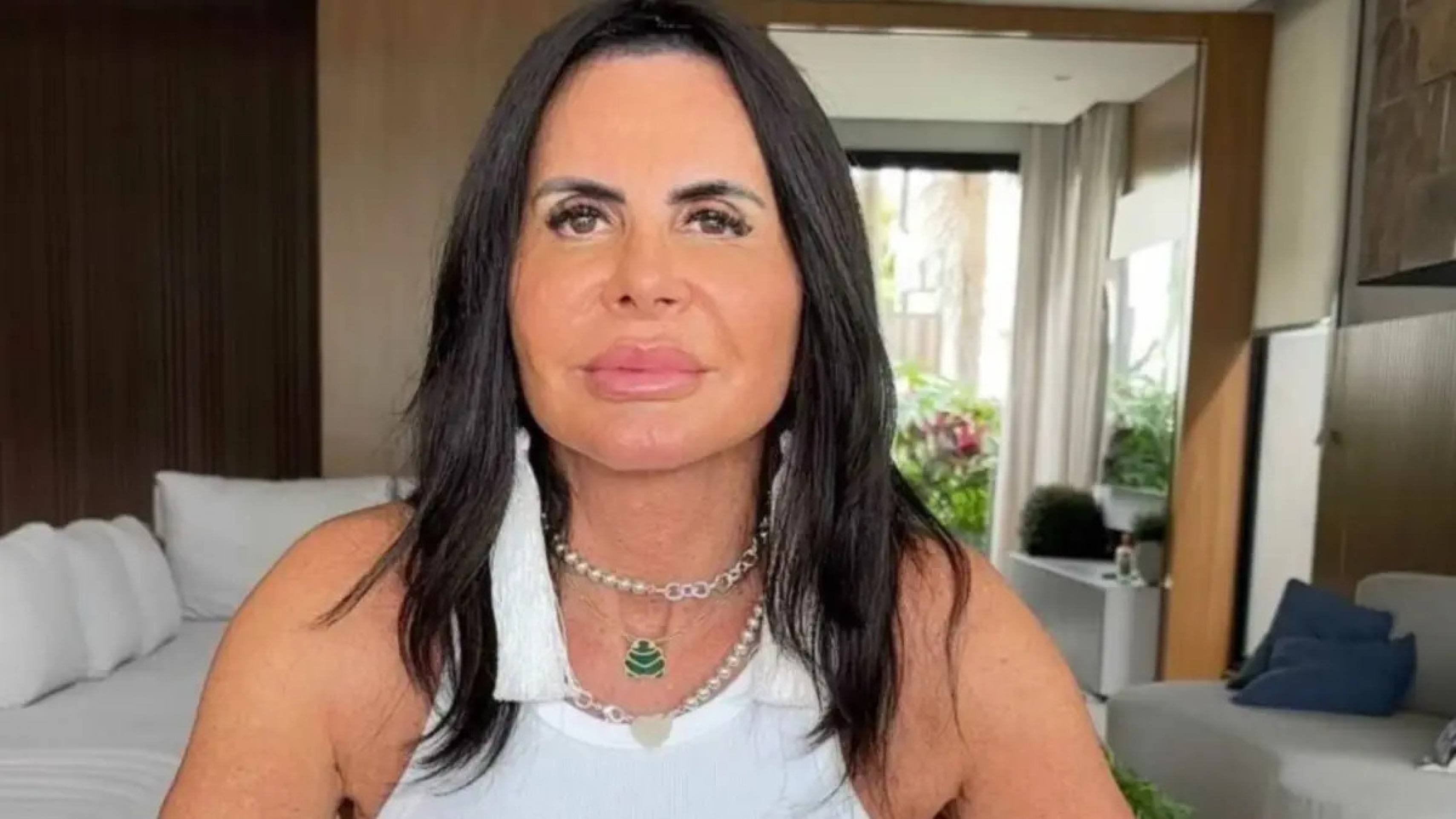 Gretchen surpreende ao exibir fios mais fortes após tratamento de alopecia Gretchen surpreende ao exibir fios mais fortes após tratamento de alopecia