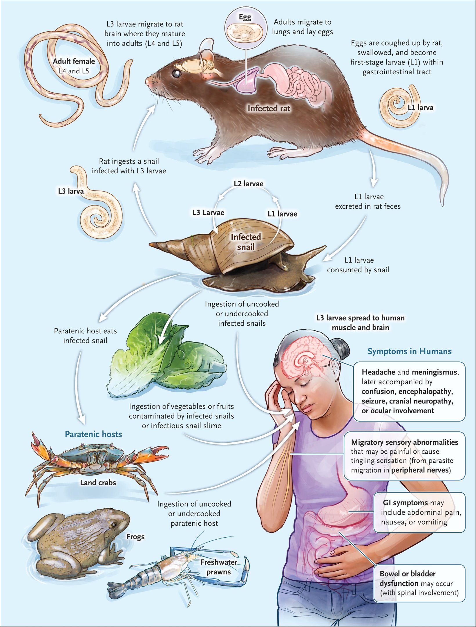 Ciclo de vida de Angiostrongylus cantonensis e sintomas de infecção Ciclo de vida de Angiostrongylus cantonensis e sintomas de infecção
